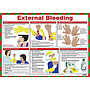 First aid for external bleeding poster